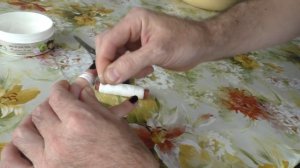 Как снять кольцо с опухшего пальца