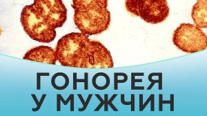 Гонорея у мужчин. Лечение гонореи.