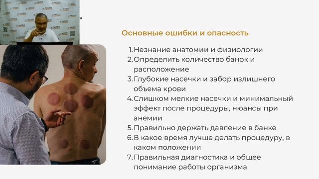 ХИДЖАМА: БОЛЕЗНЬ БЕХТЕРЕВА И РЕВМАТОИДНЫЙ АРТРИТ / ЛЕЧЕНИЕ ХИДЖАМОЙ / ПРИМЕРЫ ИЗ ОПЫТА
