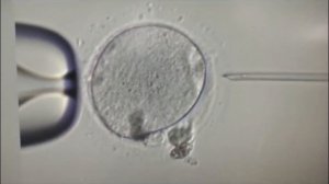 Процедура ИКСИ (icsi)