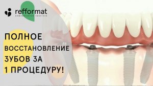 Как проходит имплантация зубов все на 4. Имплантация зубов все на 4. 12+