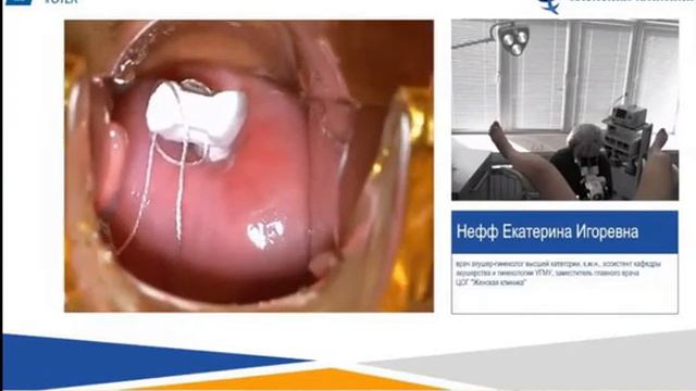Применение дилатора производства _РЦ - Биомедикал_ при подготовке к офисной гистероскопии смотреть онлайн
