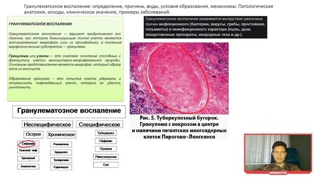 Патологическая анатомия | ВОСПАЛЕНИЕ. Часть 2
