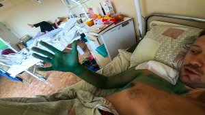 Снял первую пластину из плеча