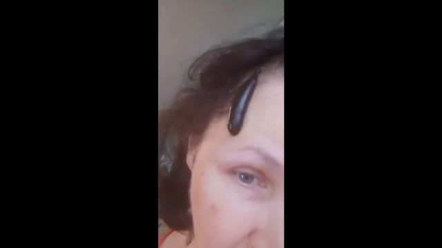 СТАВИМ ПИЯВКИ ОТ ОБЛЫСЕНИЯ И ОТ ГОЛОВНОЙ БОЛИ смотреть онлайн