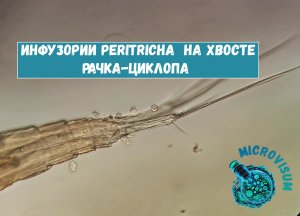 Инфузории Peritricha  на хвосте рачка-циклопа