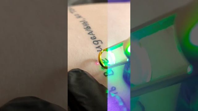 Как удалить татуировку? За один раз? Быстро? Не больно? Да, пожалуйста??? смотреть онлайн