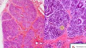 Дифференциальная диагностика экзаменационных препаратов по гистологии. Видео лекция С.М.Зиматкин