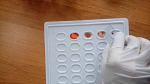 Определение группы крови, резус фактора | Қан тобын, резусын анықтау