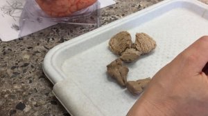 ‪Продолговатый мозг 4