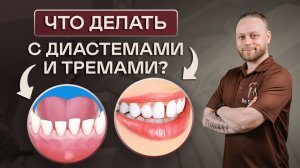 Что делать с диастемами  и тремами? Пути решения проблемы тремов и диастем.