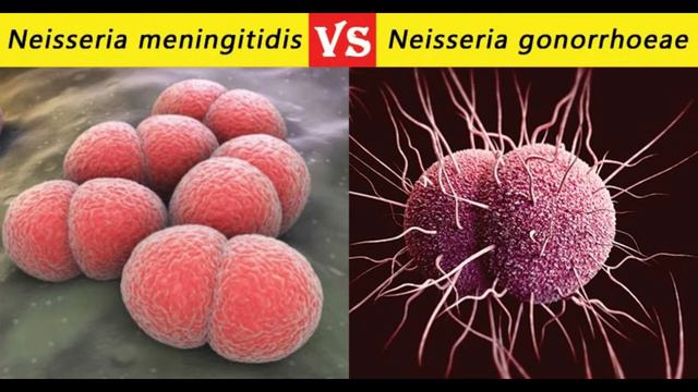 Neisseria Meningitidis Vs Neisseria Gonorrhoeae  32 Differences