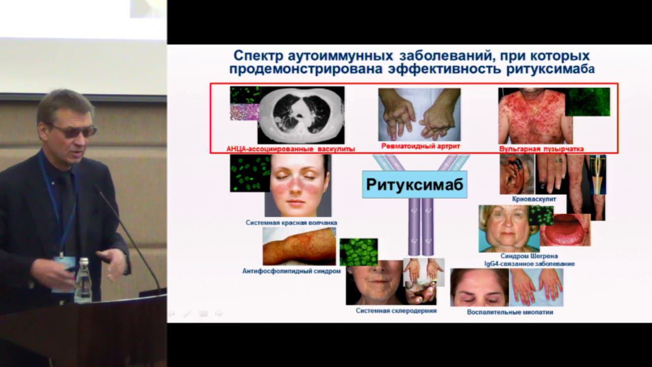 Насонов Е.Л., Достижения ревматологии-2017 | Перспективные разработки,  Аутоиммунные заболевания