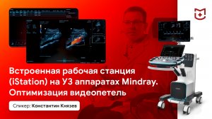 Встроенная рабочая станция (iStation) на УЗ аппаратах Mindray. Оптимизация видеопетель