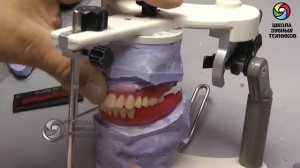 (ПСП 6) Лабораторный этап: Постановка боковой группы зубов.