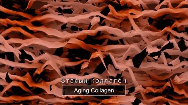 Face lifting and skin tightening hifu Treatment Principle ｜MBT смотреть онлайн