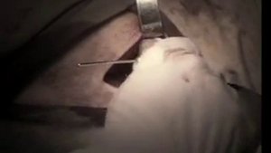 Челюстно Лицевая Хирургия госпиталь Бурденко