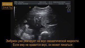 22 неделя беременности. Развитие плода. Что чувствует беременная. Как выглядит ребенок на 22 неделе