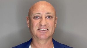 ДО и ПОСЛЕ блефаропластики верхних и нижних век.