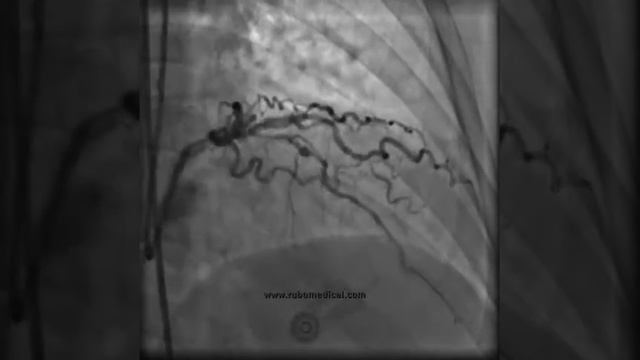 после баллона смотреть онлайн