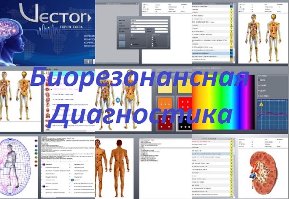 Биорезонансная диагностика
