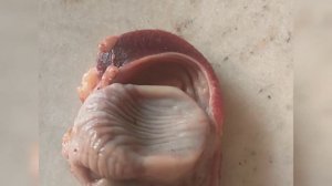 Лечение Дизентерия