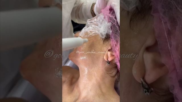 Холодная Плазма | Спектральная фототерапия | Обучение