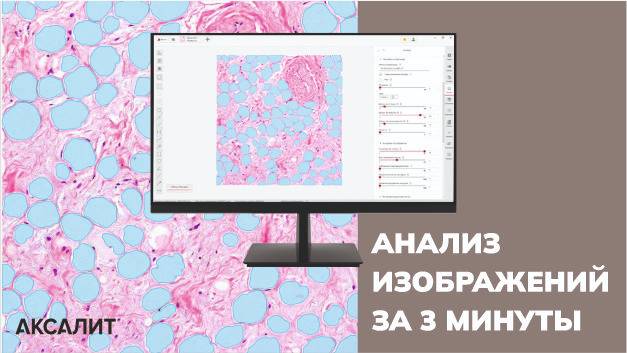 Анализ биологических образцов: методика, инструменты, результаты