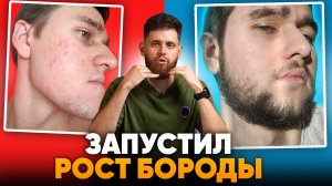 Ксиноксин помог пробить рост бороды / Результаты за 5 месяцев