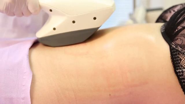 Элос коррекция фигуры на аппарате слиминг 3. смотреть онлайн