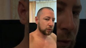 Алерана 5% , 2 месяца использовал не сбривая волос , результат в видео .