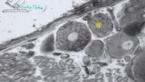 КОМПЛЕКС ГОЛЬДЖИ