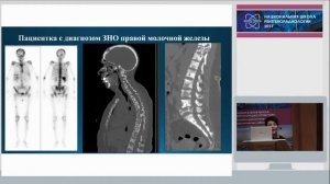 Н.Ю. Шумилина - ОФЭКТ/КТ исследование в дифференциальной диагностике поражений костной системы