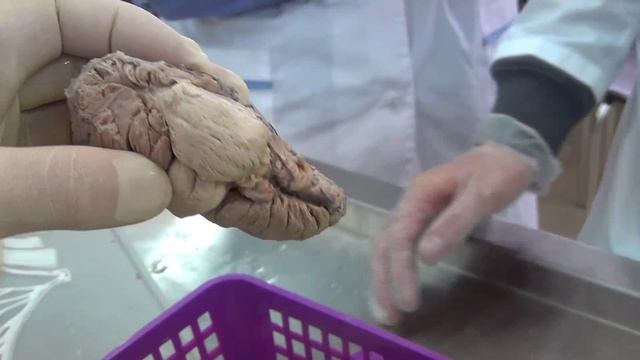 Анатомия ствола мозга на трупе, лекция профессора Изранова