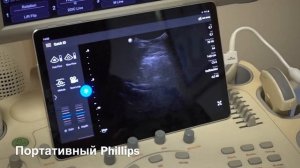 Обзор портативного узи аппарата Philips Lumify