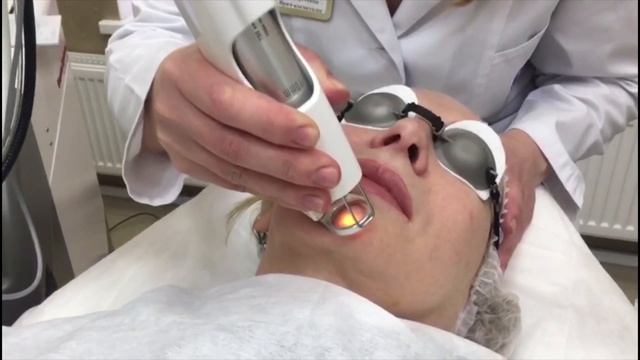 Уход за лицом. Глубокое дермальное омоложение смотреть онлайн