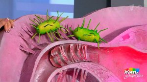 Хламидия - микроб-диверсант. Жить здорово! Фрагмент выпуска от 06.04.2017