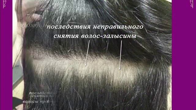 Ужасы наращивания волос и неправильного ухода.