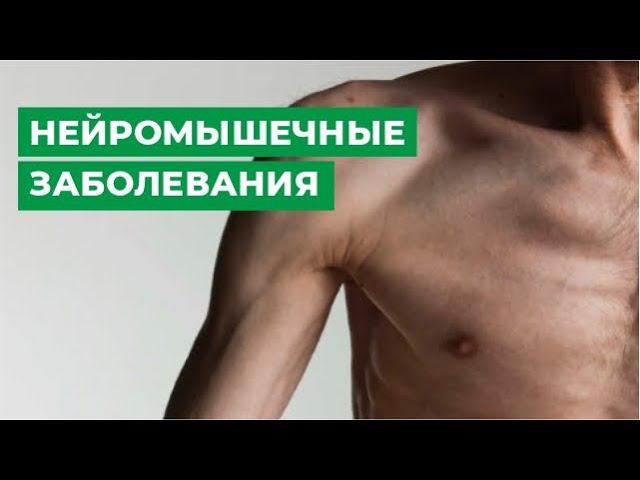 Нейромышечные заболевания: миастения, ботулизм, боковой амиотрофический склероз