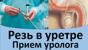 Резь в уретре. Прием уролога