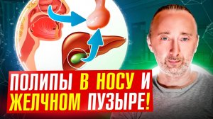 Полипы в носу и желчном пузыре: надёжное лечение БЕЗ операций, ДОМА!