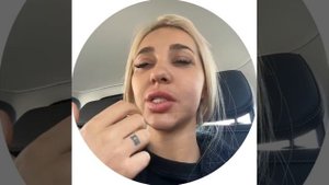 Дом 2! у Насти Стецевят сломались зубы)