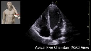 Apical Five Chamber View (A5C). Perioperative & Critical Care ECHO/ POCUS