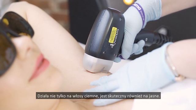 Bezbolesna epilacja laserowa Soprano Titanium | Anna Retkowska kosmetologia estetyczna Łódź смотреть онлайн