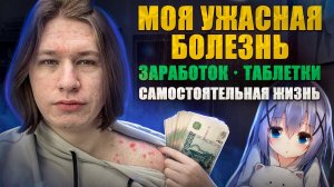 Какого Жить Одному Школьнику СПУСТЯ 5 ЛЕТ #2 Моя болезнь, заработок, рум-тур, история из жизни