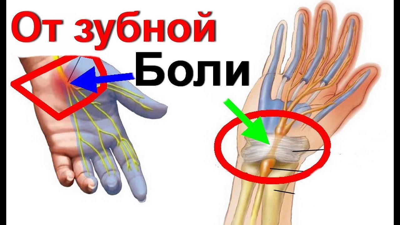 Убрать зубную боль за 1 минуту без лекарств/ Су Джок