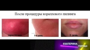 Пилинг Rose de Mer