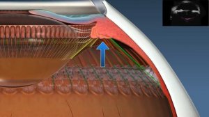 Механизм аккомодации (Daniel Goldberg 2011)