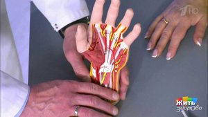 Онемение рук по ночам. Жить здорово! Фрагмент выпуска от 21.04.2020