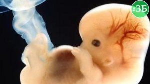 Зачем Мужчинам Соски ?! #ABS10